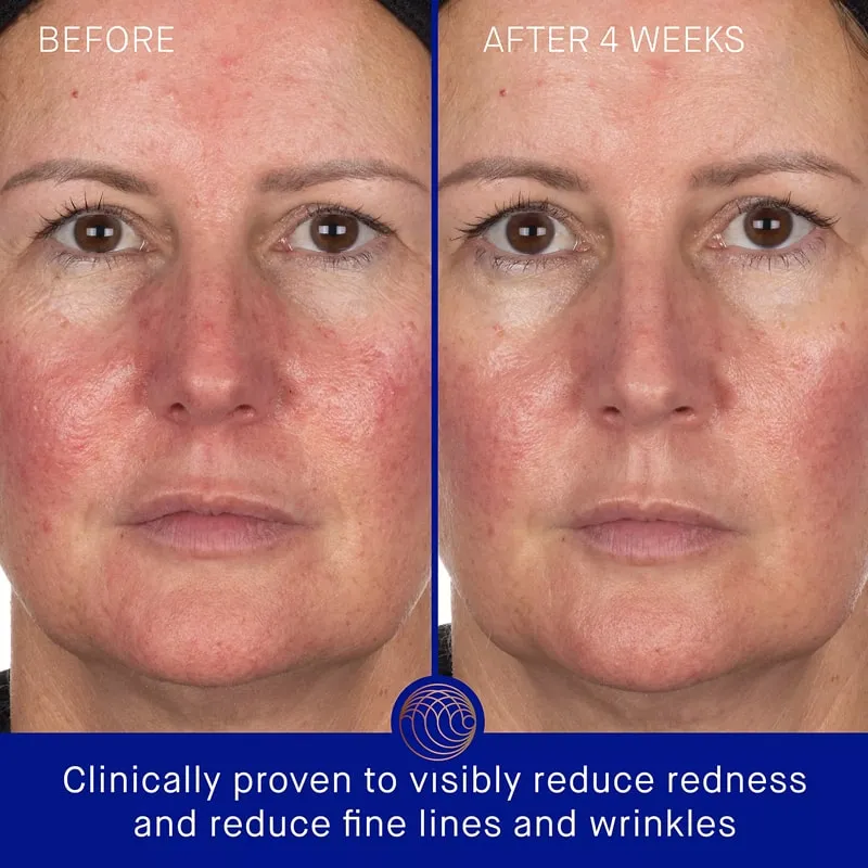 The Hydrogel Face Mask
